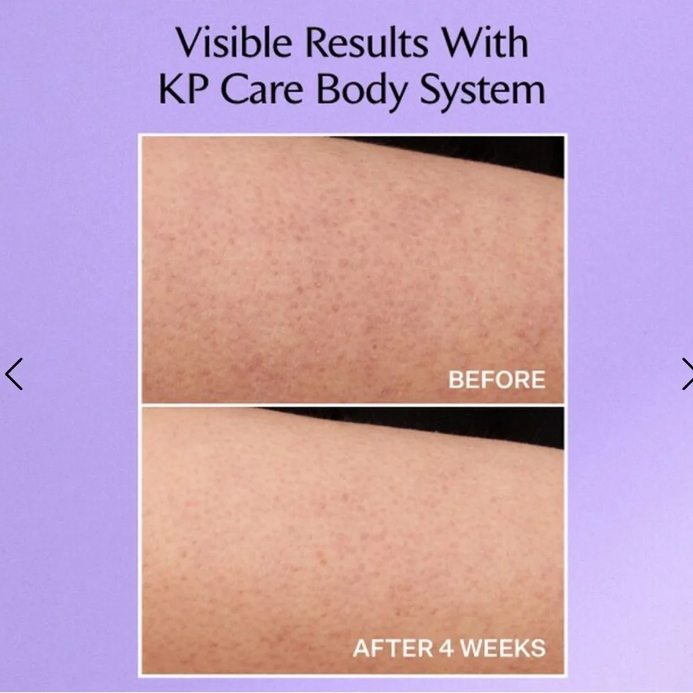 StriVectin kp care