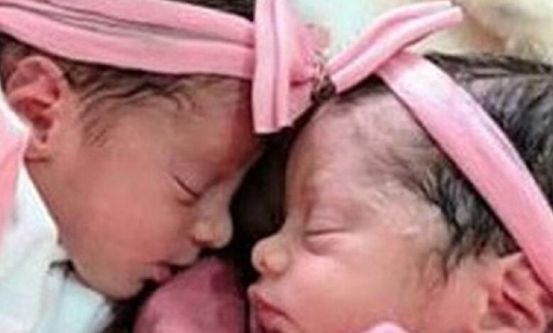 Recém-nascidas gêmeas, de 26 dias, morrem após serem atacadas por cachorro da família