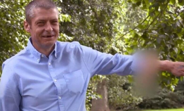 Homem tem pênis reconstruído e implantado no braço