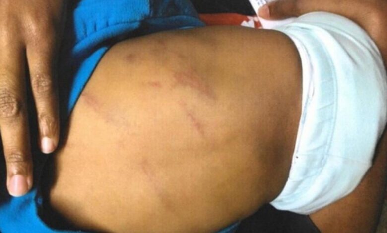 Padrasto é preso após agredir bebê de 9 meses com um chicote no DF