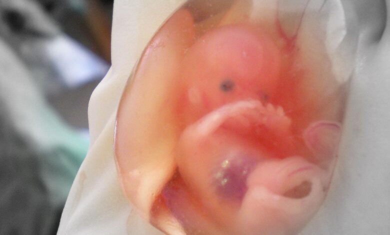 Brasil e EUA articulam aliança mundial antiaborto, diz colunista